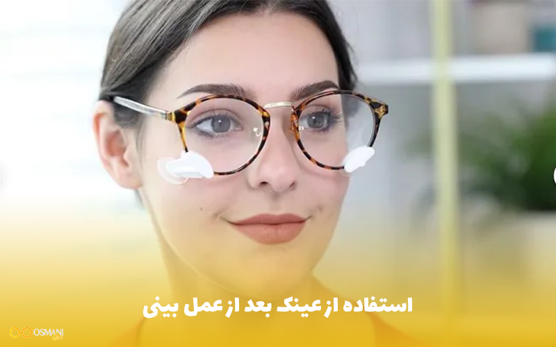استفاده از عینک بعد از عمل بینی