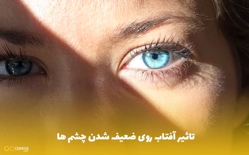 تاثیر آفتاب روی ضعیف شدن چشم ها