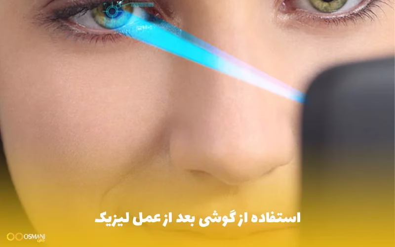 استفاده از گوشی بعد از عمل لیزیک